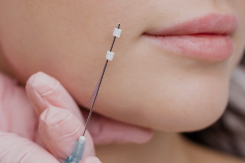 울트라 V 리프팅