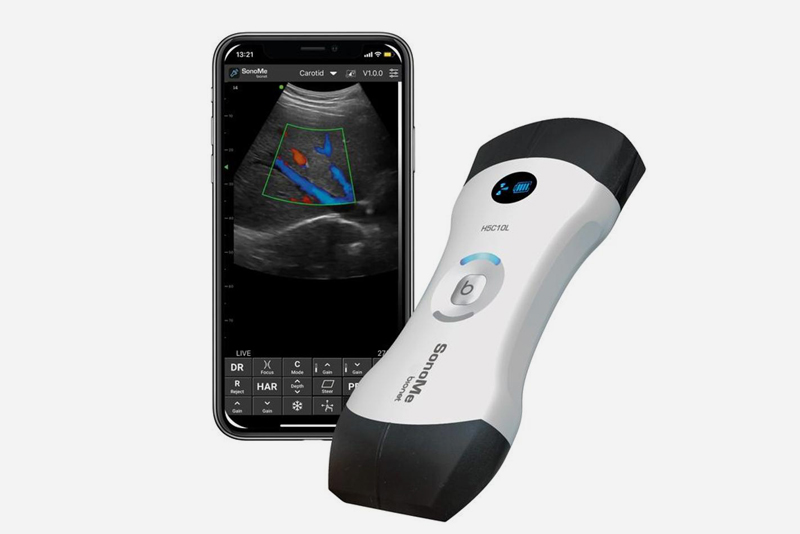 피하종양, 소노미 무선 초음파