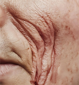 치유앤미 안면 외상