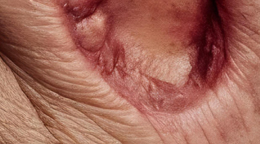 치유앤미 안면 외상