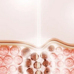 치유앤미 재생관리