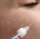 치유앤미 무통 스킨부스터 이런 분들이 오십니다