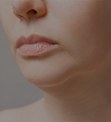 치유앤미 피팅 리프팅 이런 분들이 오십니다